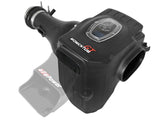 INTAKE KIT 17-23 TITAN