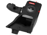 TAKEDA INTAKE KIT 23-24 CIVIC/2024 INTEGRA TYPE S 2.0L